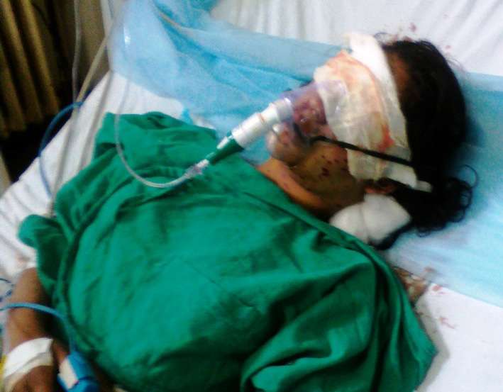 15-year-old-Insha-was-crippled-with-pellets-in-her-home.jpg