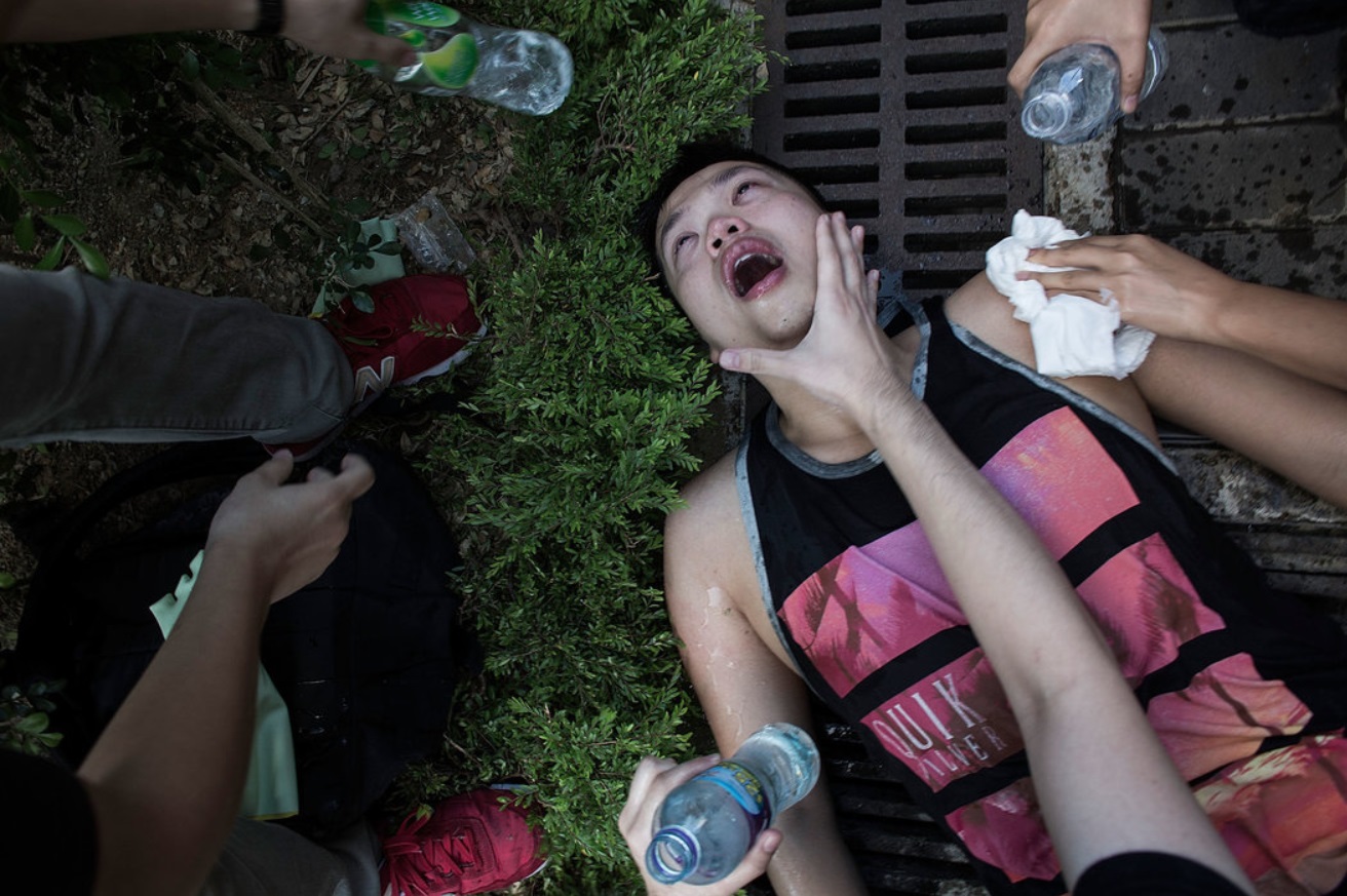 An injured protester was treated after clashing with the police..jpg