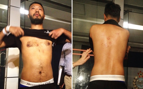 Bearded Hong Kong protester tortured by officers in dark corner.jpg