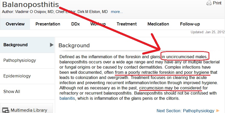 Circumcision - Chronic Balanoposthitis.jpg