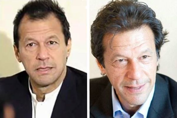 Imran-Khan-Hair-Transplant.jpg