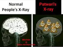 patwari brain.jpg