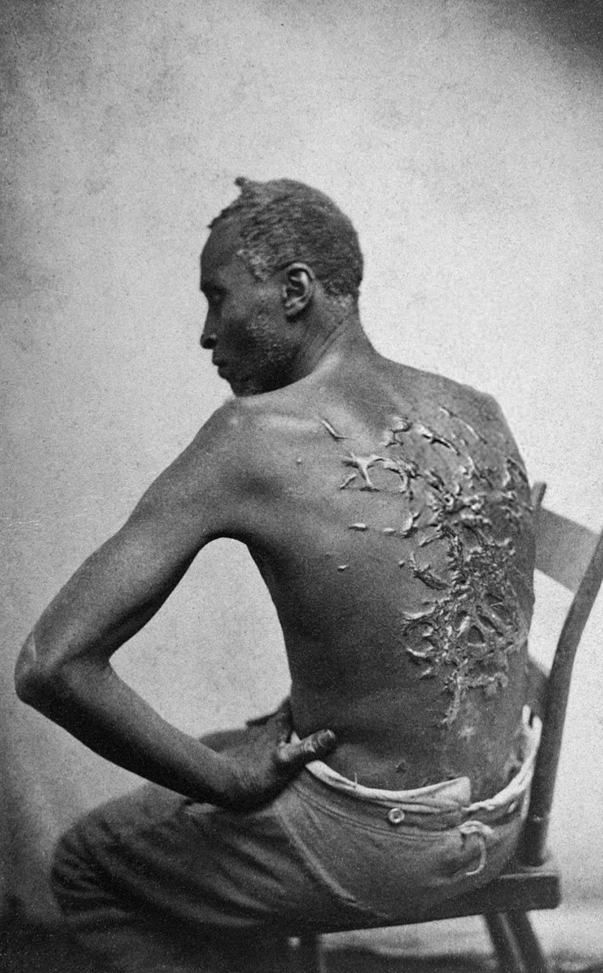 Scourged_back_by_McPherson_&_Oliver,_1863,_retouched.jpg