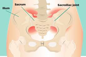 si-joint-posterior-view.jpg