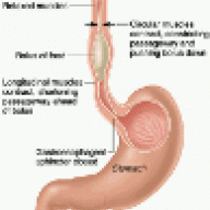 peristalsiso