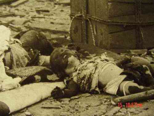 japanese-atomic-bomb-victims-16.jpg