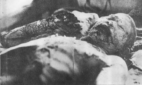 japanese-atomic-bomb-victims-34.jpg