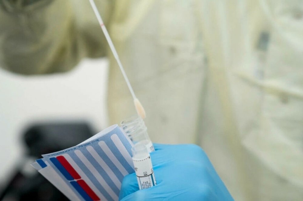 A doctor performs a mouth swab on a patient to test for for Coronavirus Covid-19 in Copenhagen, on April 2, 2020. — AFP/File