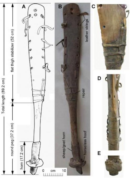 leg-prosthesis.jpg