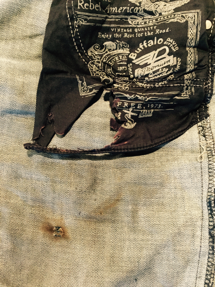 philips-jeans-after-accident.jpg