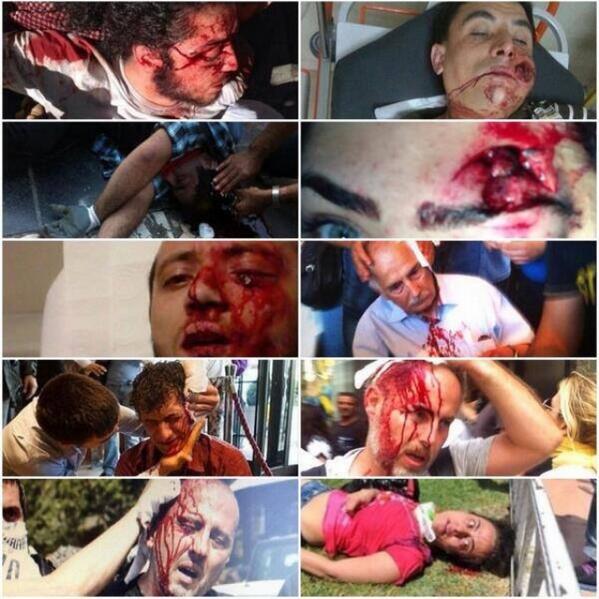 this-is-police-brutality-in-Turkey-occupygezi1.jpg