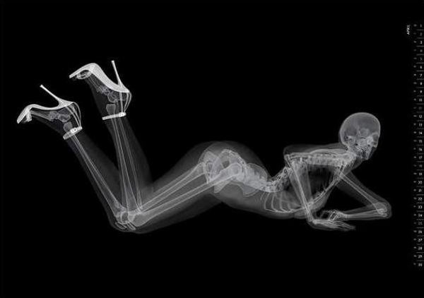 miss+september+x-ray+pin+up.jpg