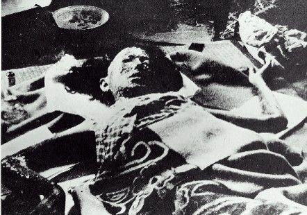 a-bomb-hiroshima-victim-1.jpg