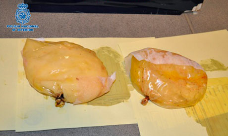 Cocaine-breast-implants--008.jpg