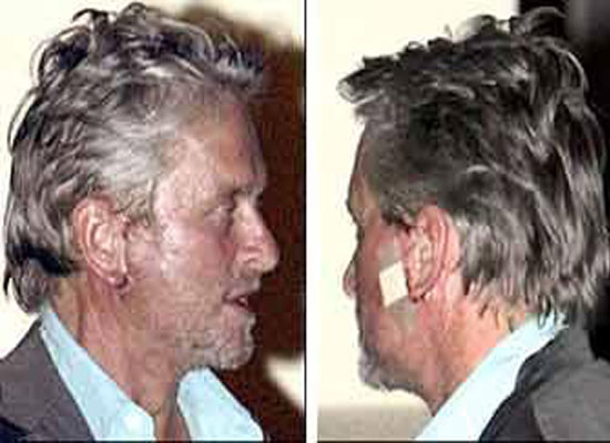 Michael-Douglas-Plastic-Surgery-Face.jpg