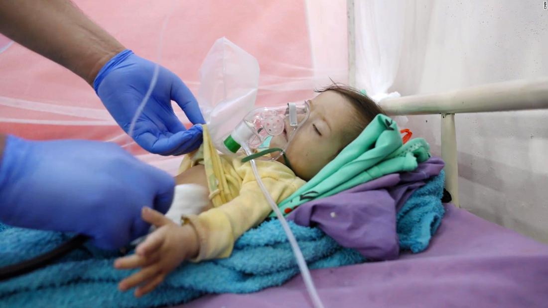 Ten-month-old Hassan Ali, who died in a hospital in Abs, Yemen, where he was being treated for malnutrition.