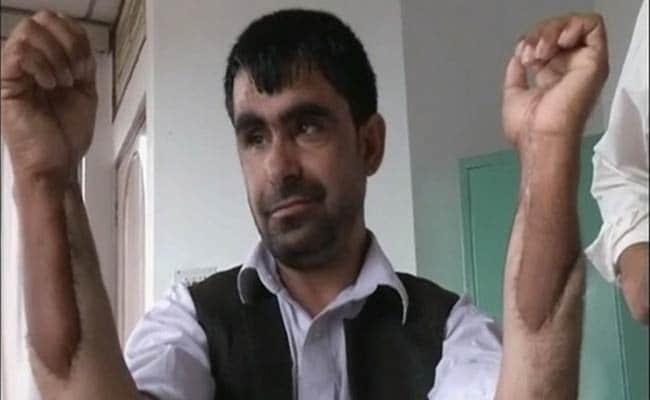 afghan-soldier-hand-transplant_650x400_71431838518.jpg