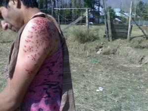 pellet-gun-injured-bandipore-kashmir.jpg