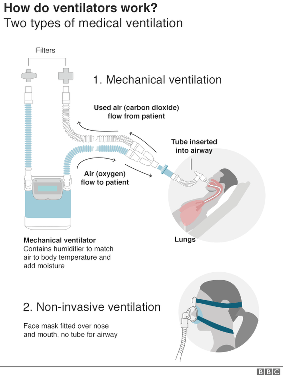 _111484691_covid19-ventilator_3-nc.png